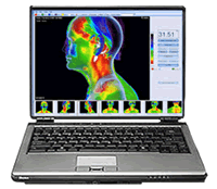 infrarot-medizinische-thermografie-software-3